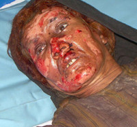Injured woman